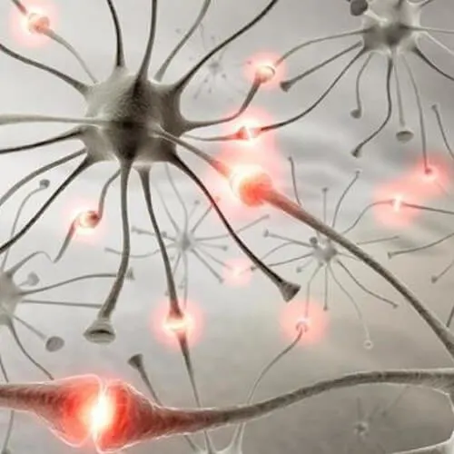 Stem Cell Therapy for Monomelic Amyotrophy