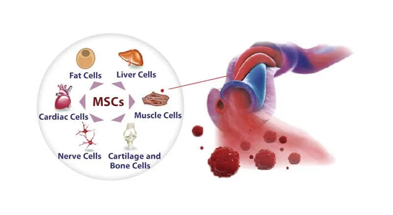 Umbilical Cord Tissue Stem Cells